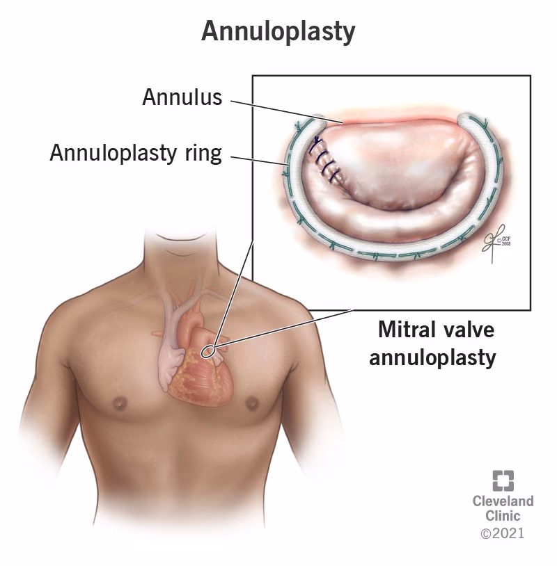 Where is the annulus located in the heart?