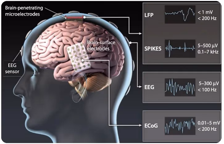 What is brain-computer interface (BCI) in stroke rehabilitation?