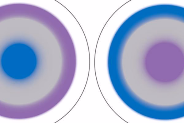 What happens during a biofinity multifocal lens fitting?