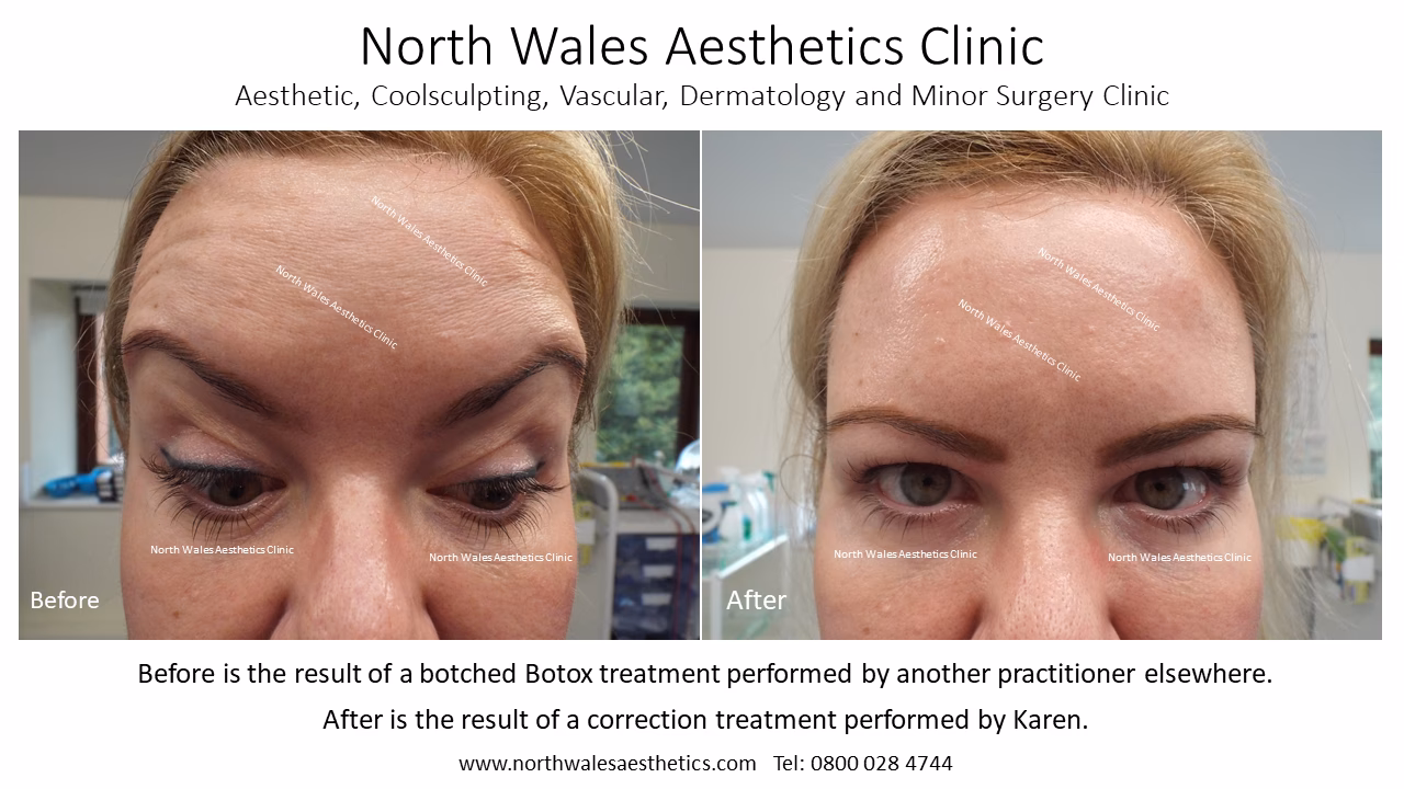 What's it like to attend a Botox training course?