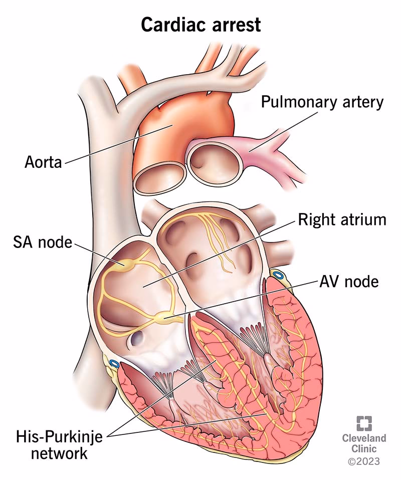 Is cardiopulmonary arrest the same as cardiorespiratory arrest?