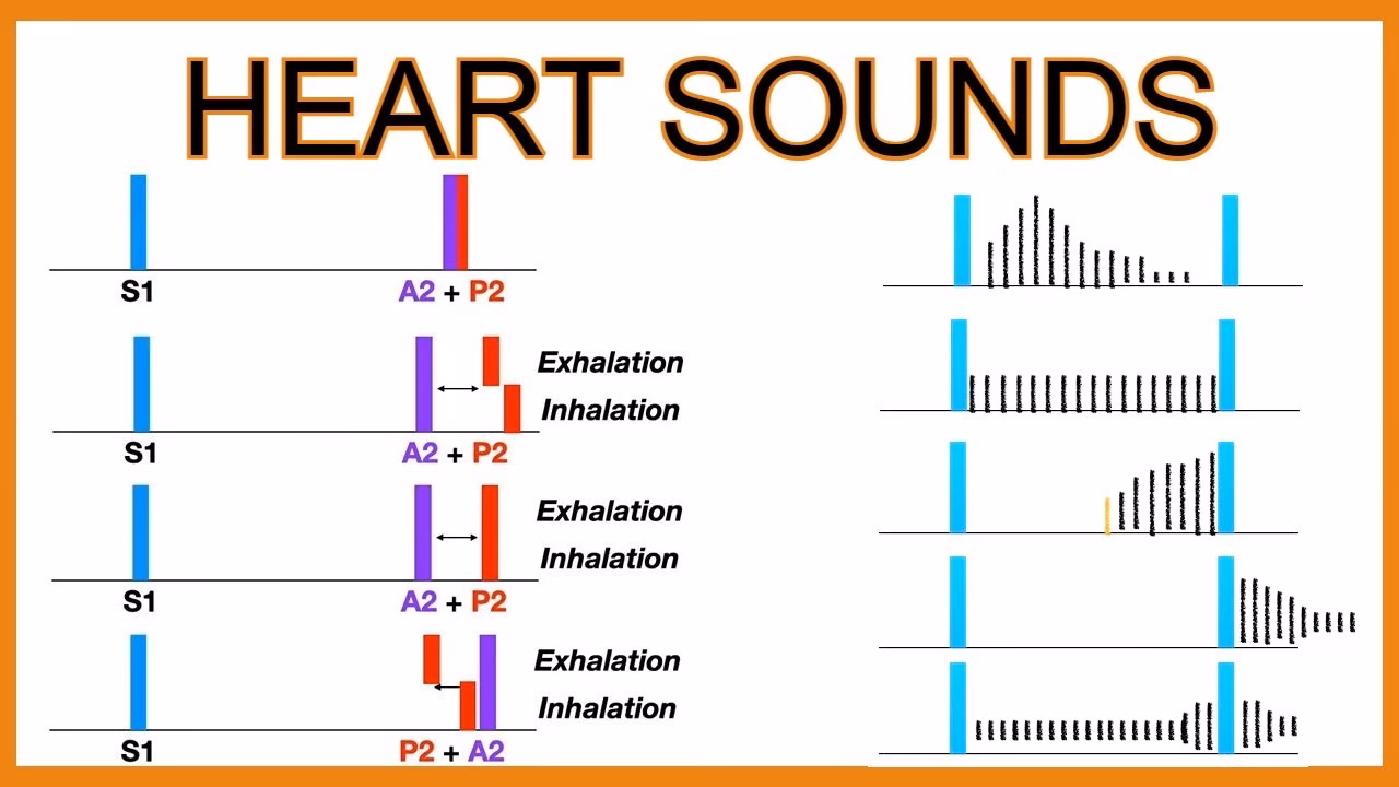 What causes a heart sound?