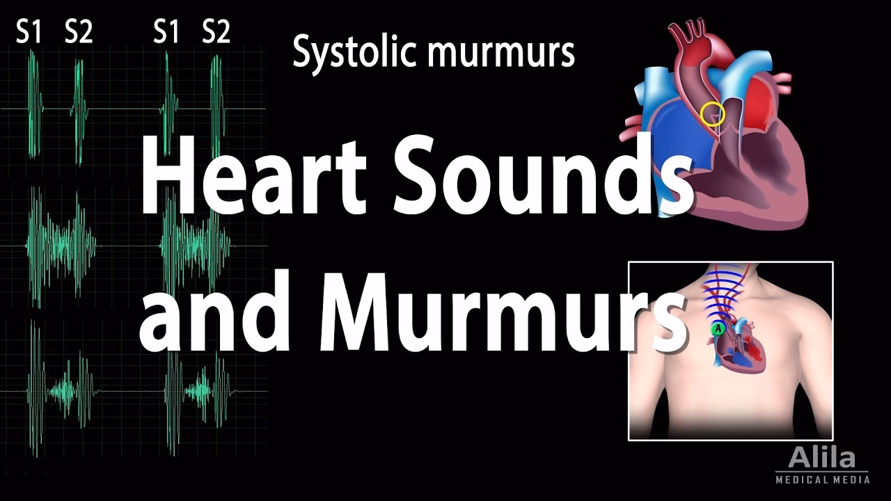 Which heart sounds can be heard during auscultation?