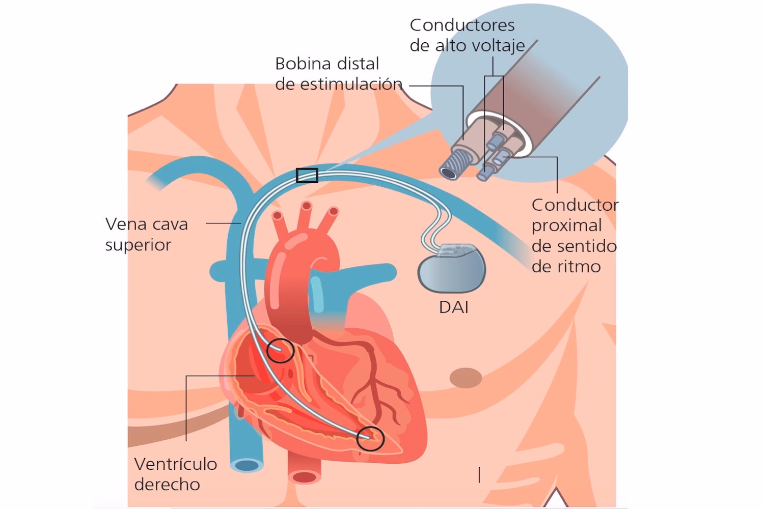 Qu'est-ce que le Dai ?
