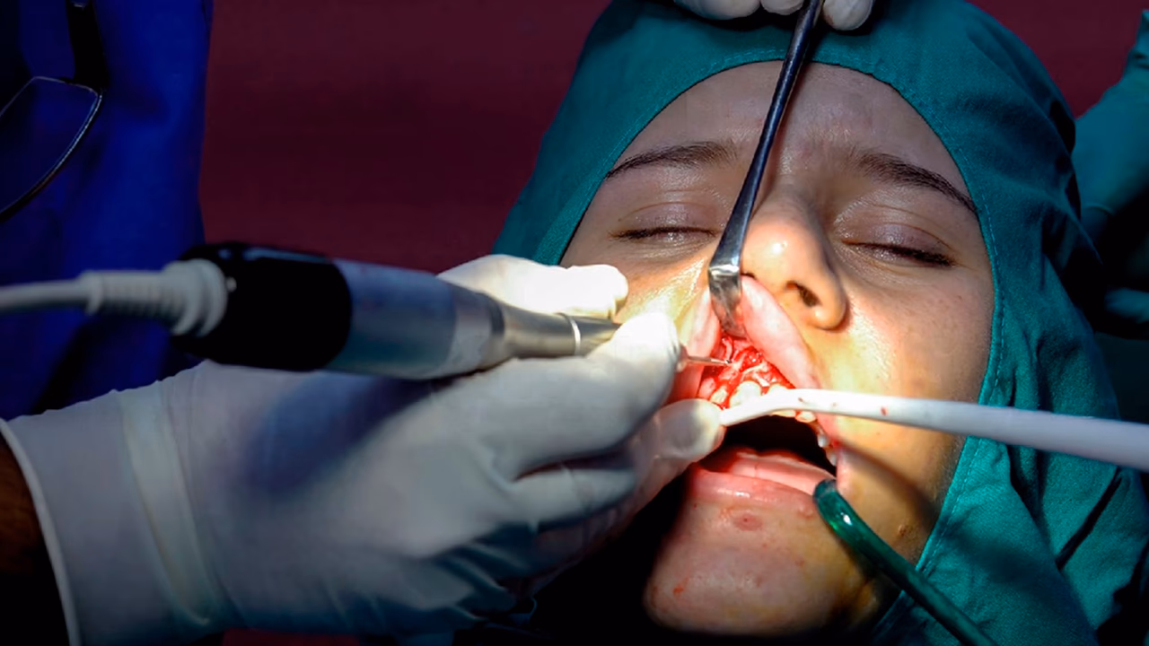 Are dental procedures safe for cardiac patients?