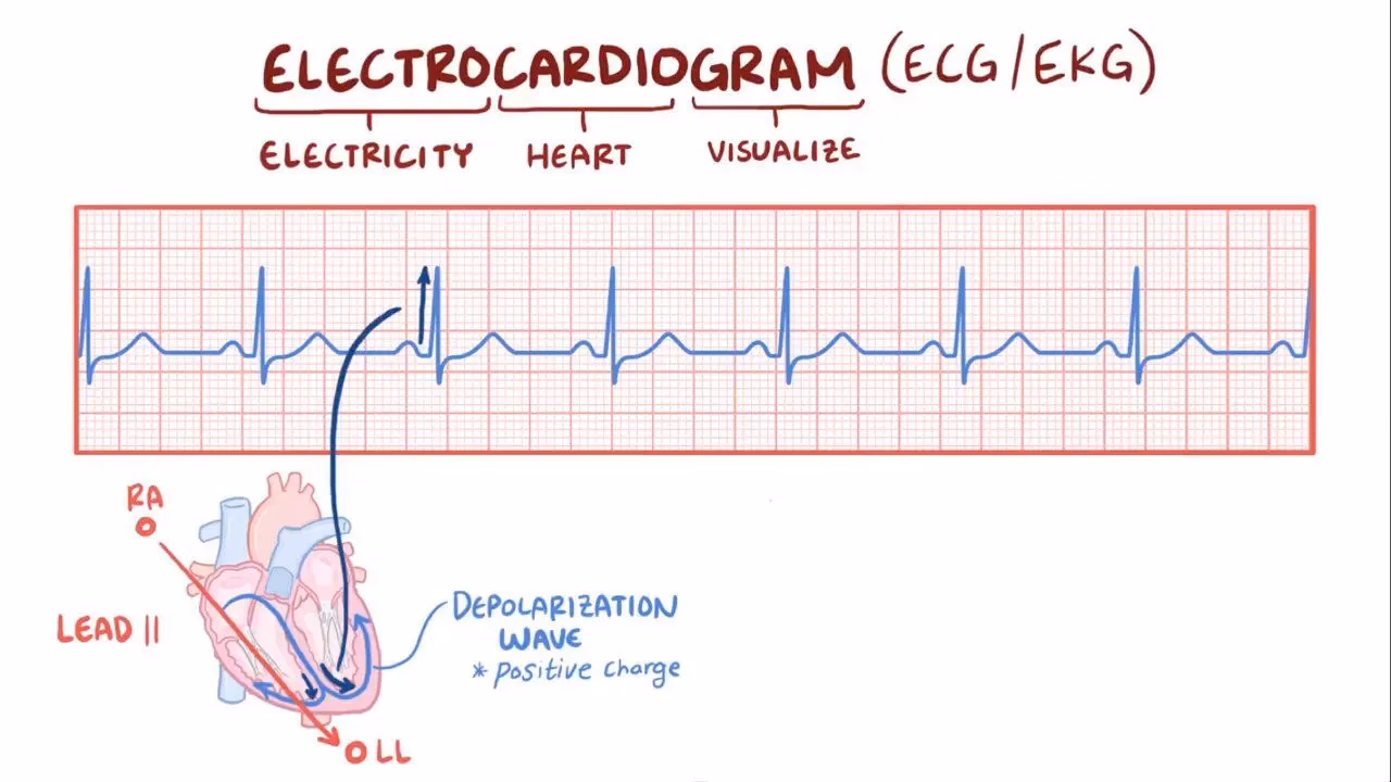 How long does it take to learn ECG interpretation?