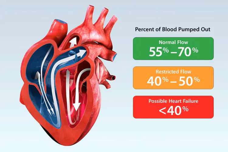 What is an ejection fraction (EF)?