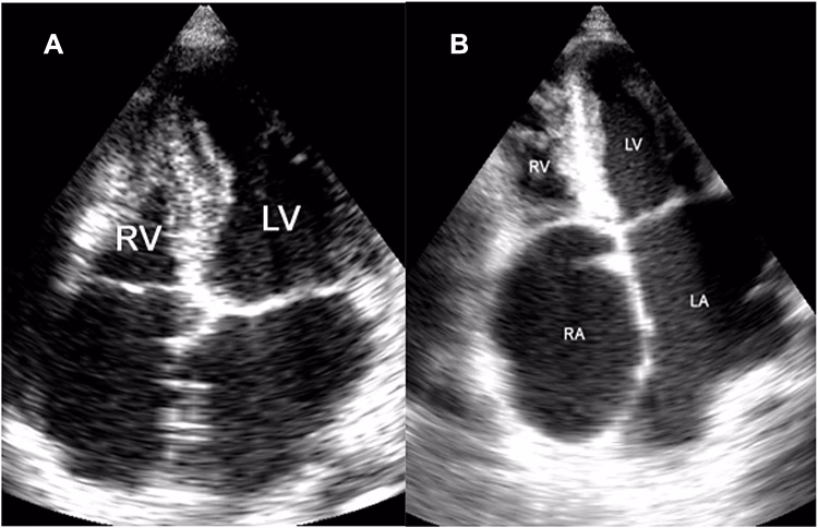 Is nonionizing EMF a therapeutic or diagnostic tool in CVDs?