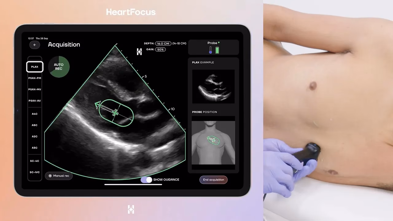 What is a Fellow of the European Society of Cardiology?