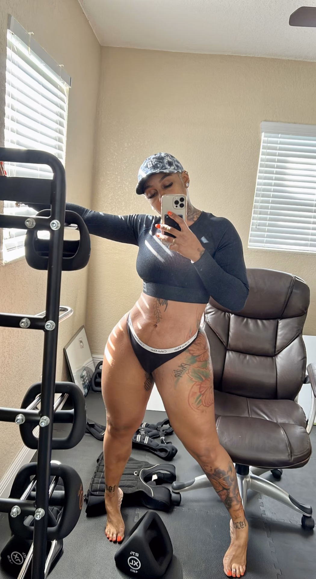 Do celebrities have stretch marks?