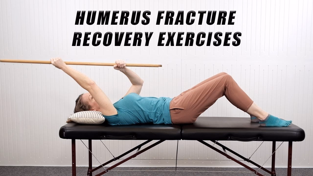 Is exercise a key principle of fracture management?