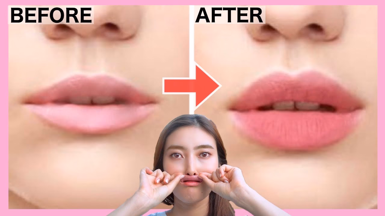 Are full lips a sign of ageing?