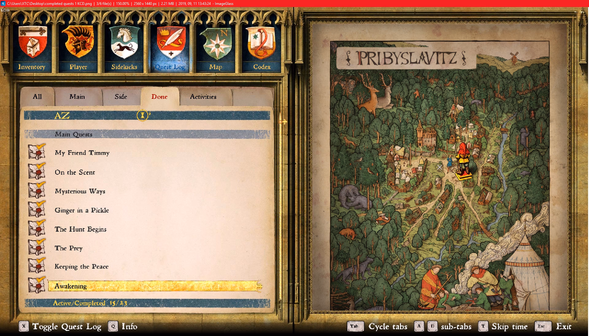 Does Bernard let you die?