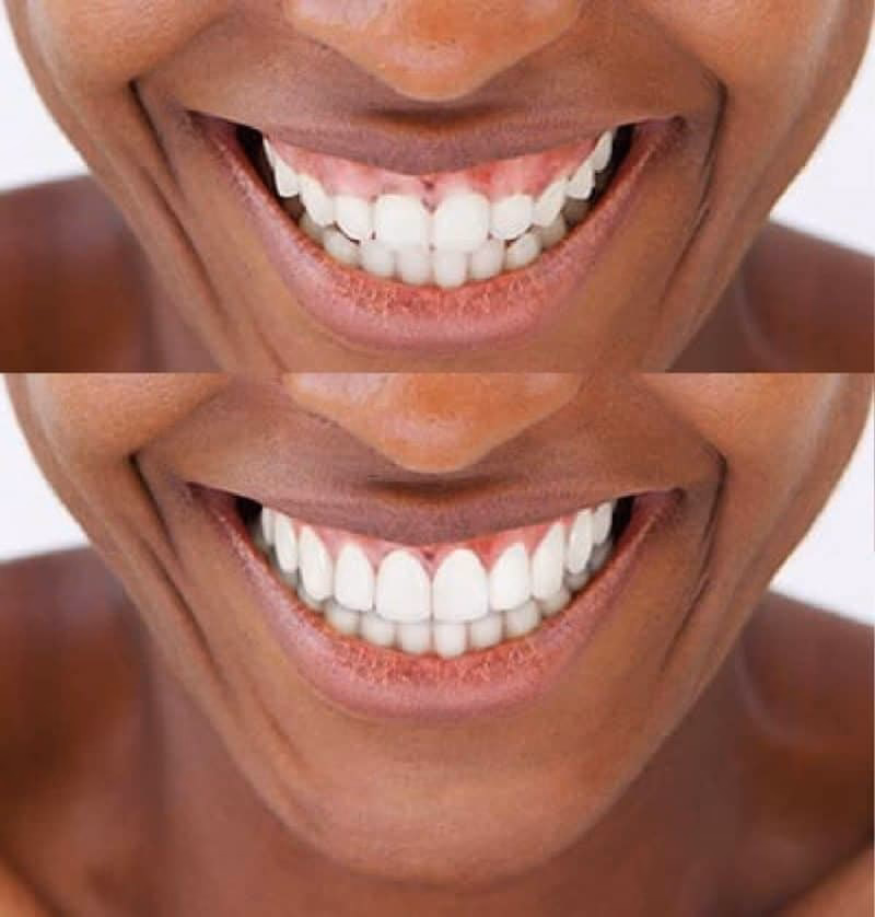 How many China workshops & meetx are there?