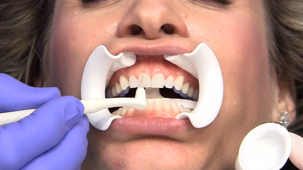 What is SAP Copa training?