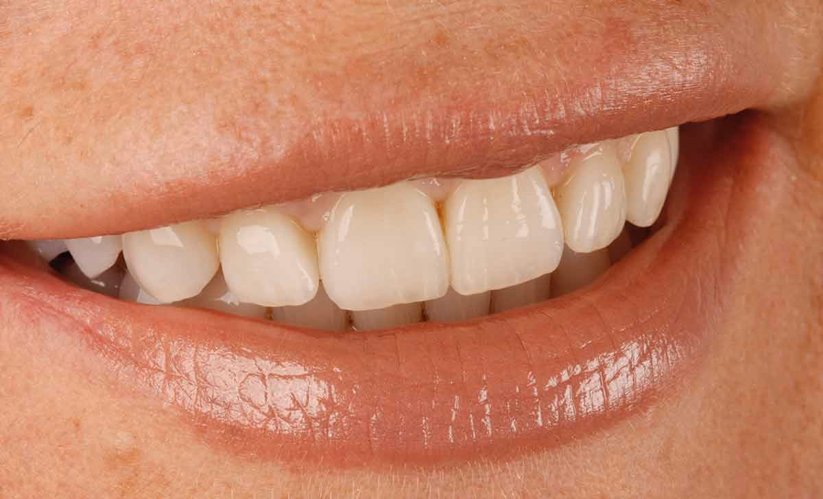 Why should you choose a short-term course in the Netherlands?