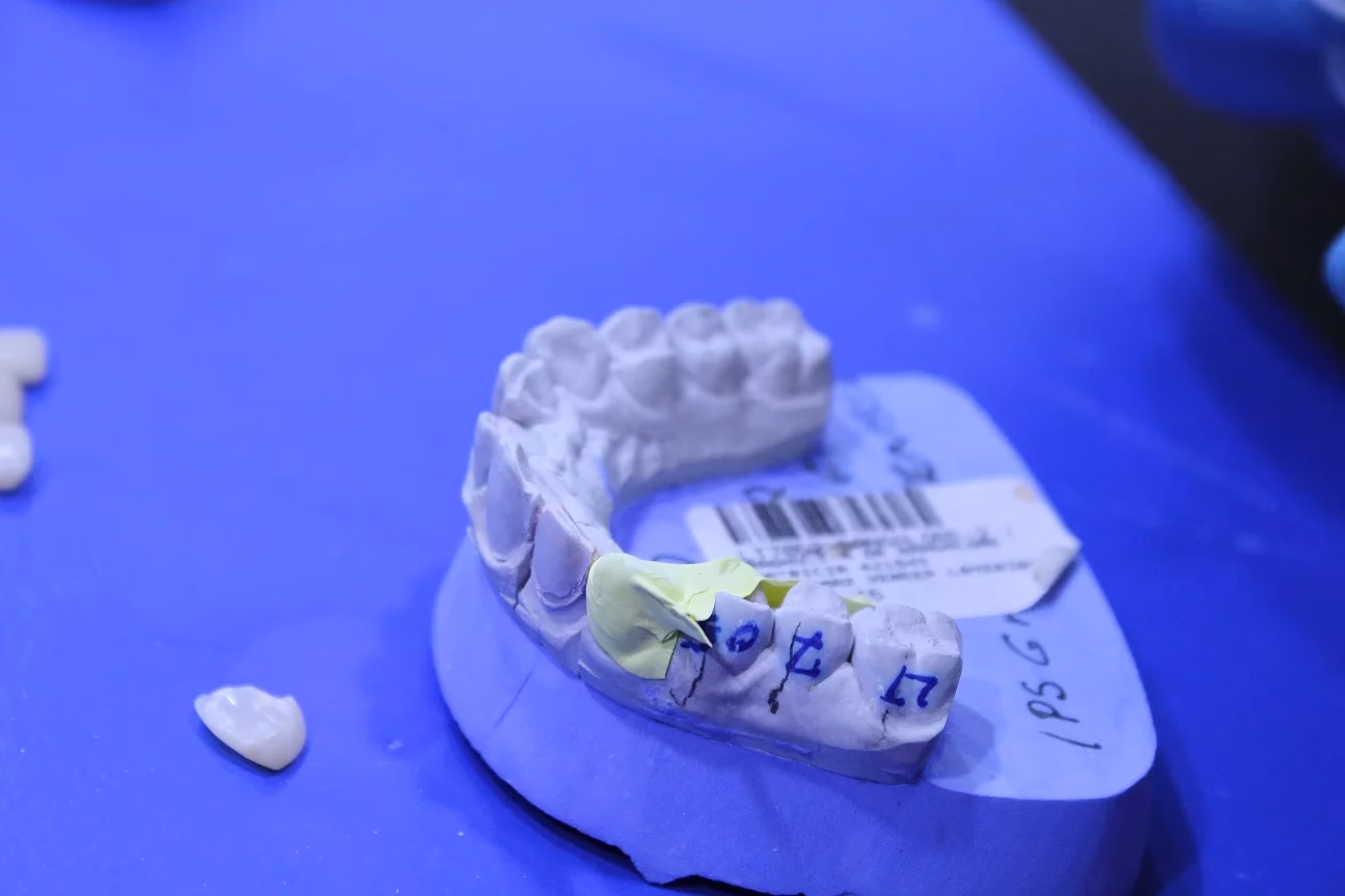 How many India workshops & meetx are there?