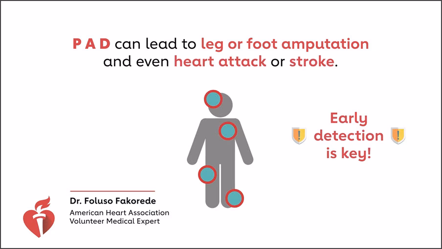 Is pad a form of cardiovascular disease?