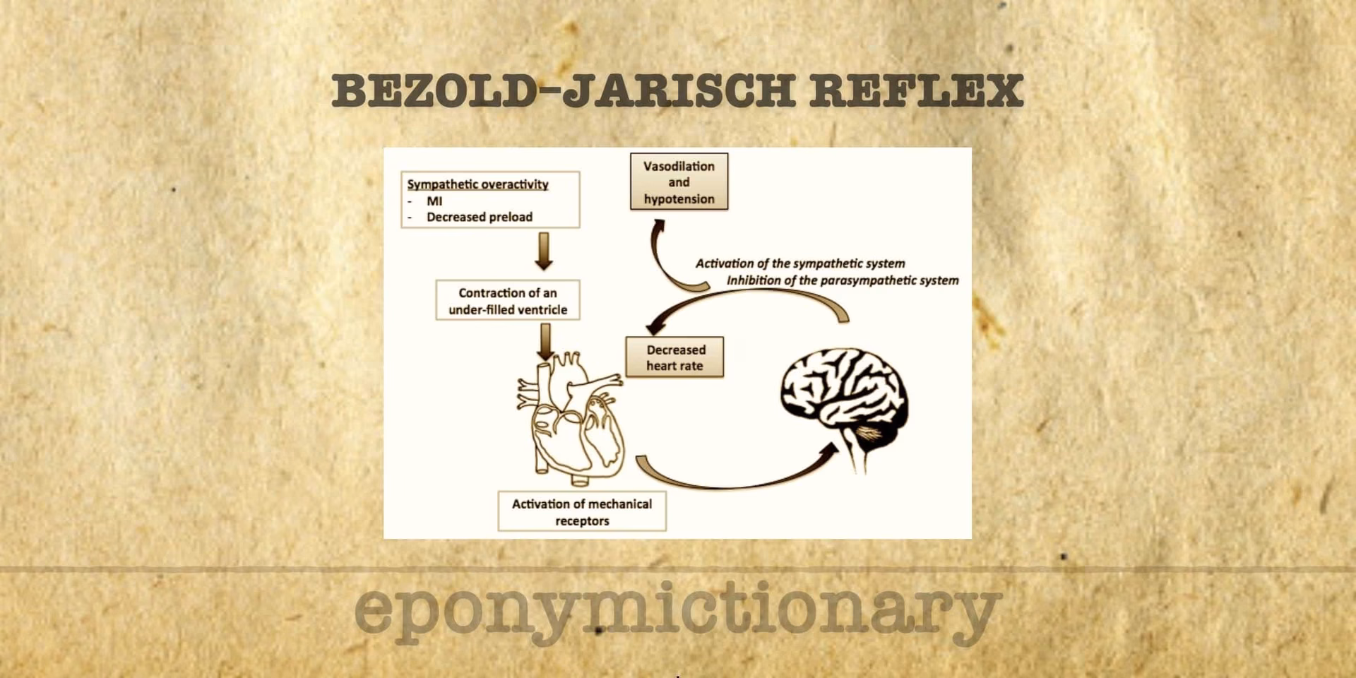 Can pacemaker therapy be used in recurrent refractory cardioinhibitory Reflex syncope?