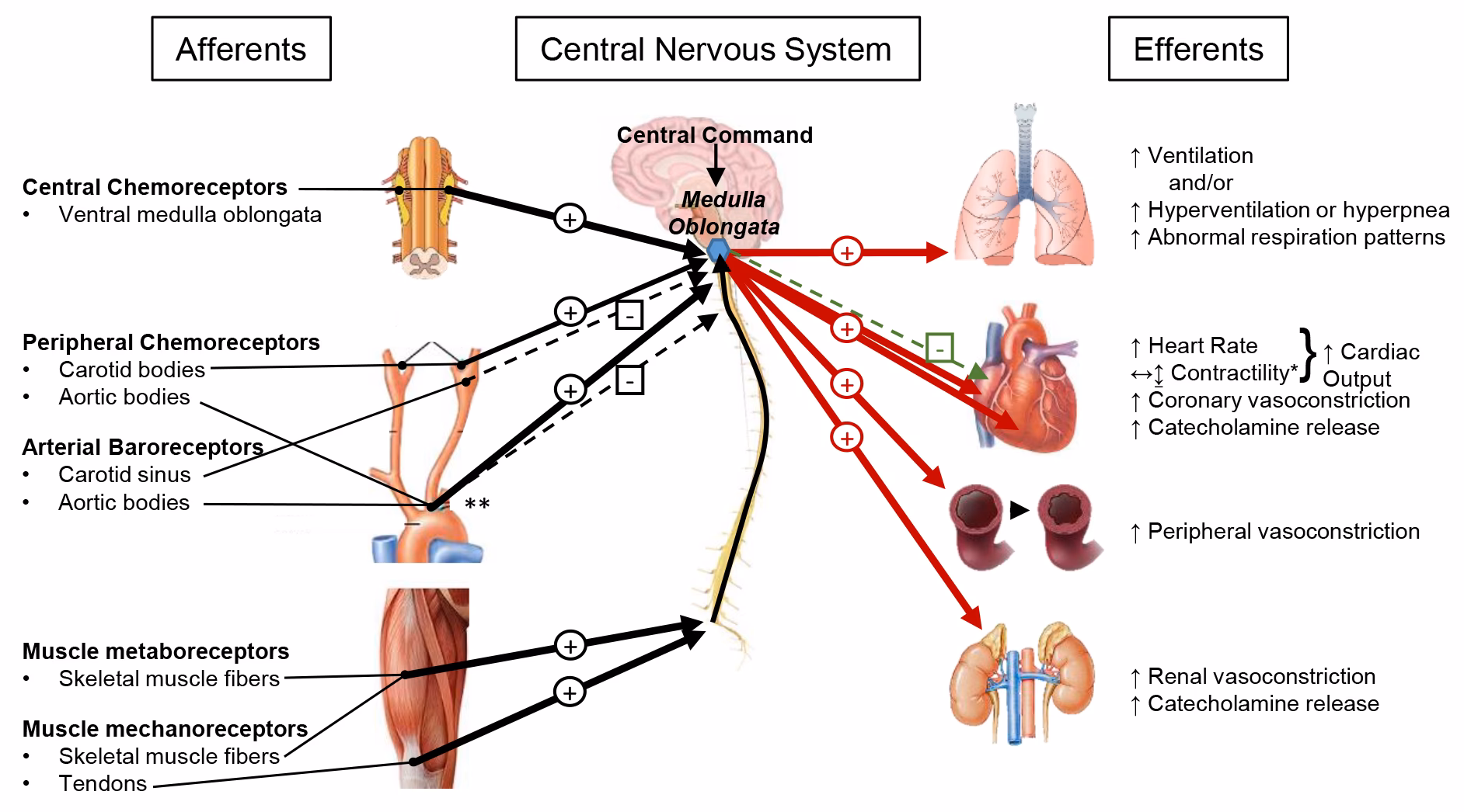 Can pacemaker therapy be used in recurrent refractory cardioinhibitory Reflex syncope?