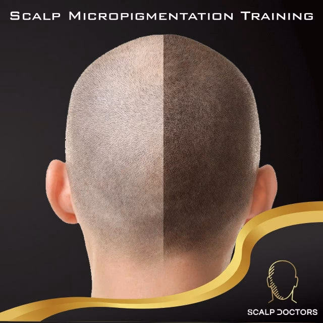 Who is scalp micropigmentation training?
